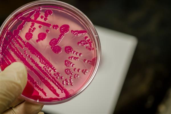 Mikrobiyolog Dr. İpek Ada Alver'den gıda zehirlenmesi uyarısı: Salmonella'ya karşı dikkat edin