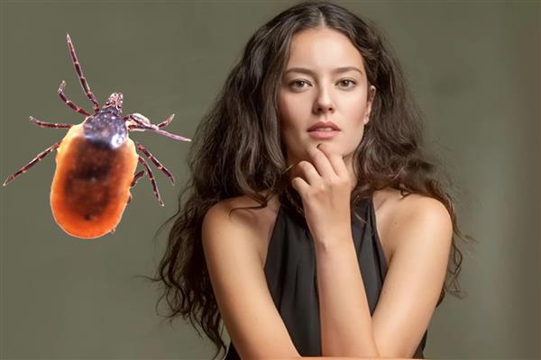 Oyuncu Pelin Akil'i kene ısırdı hastaneye koştu