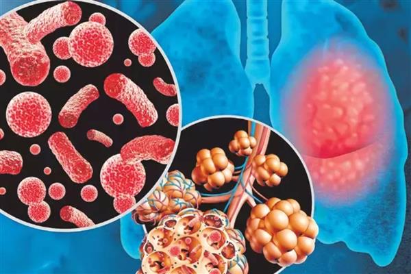 Grip ve zatürreye karşı risk grubu uyarısı: Aşıyla güçlü koruma, komplikasyonlara karşı önlem şart