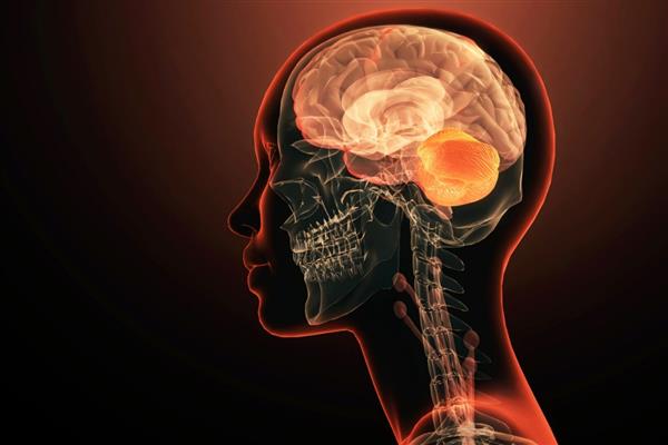 Almanya'daki araştırmacılar, tek bir genin erken başlangıçlı şizofreni ve diğer psikiyatrik bozukluklarda rol oynayabileceğini ortaya koydu