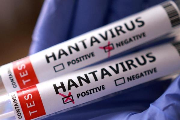 Sağlık Bakanlığı'ndan hantavirüs duyurusu, süreç titizlikle takip ediliyor